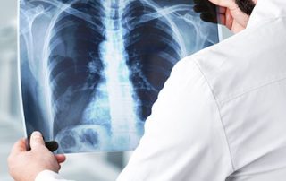 Doctor holding x ray of spine