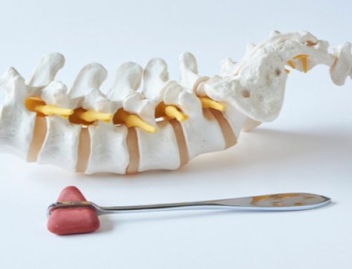 What Causes Unhealthy Lumbar Spine Alignment? | Murrells Inlet Chiropractor